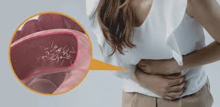 Top Signs of Worm Infections and How to Treat Them