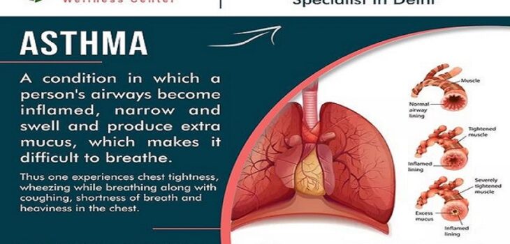 Asthma Specialist