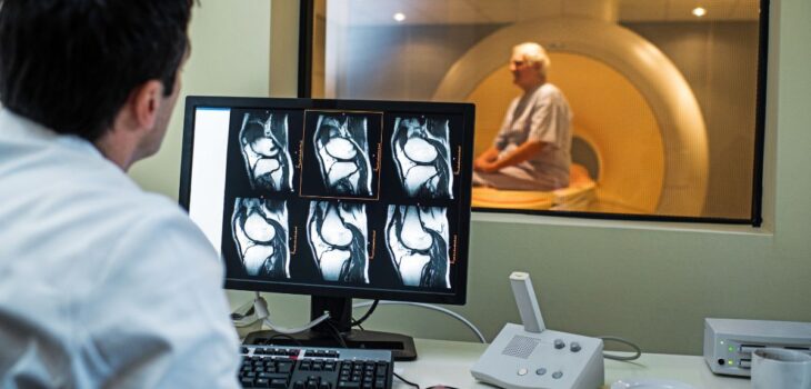 MRI Los Angeles