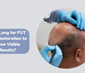 fut hair restoration