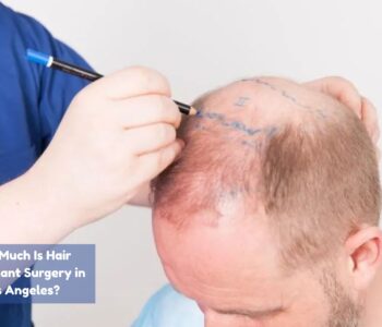 how much is hair transplant surgery