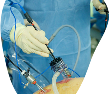 Best Laparoscopic Surgery Hospital in India