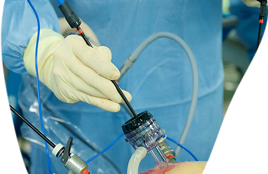 Best Laparoscopic Surgery Hospital in India