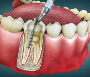 Restorative Dentistry