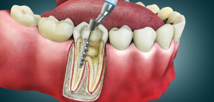 Restorative Dentistry