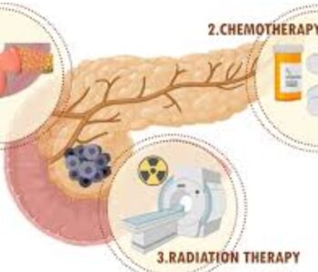 Pancreatic Cancer Treatment image (1)