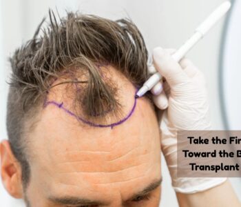 best hair transplant in usa