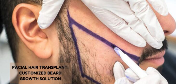 facial hair transplant