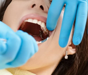 Wisdom Teeth Removal in Nottingham