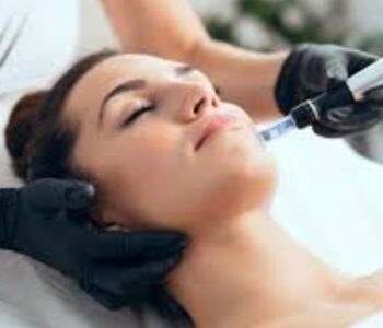 microneedling tretament images