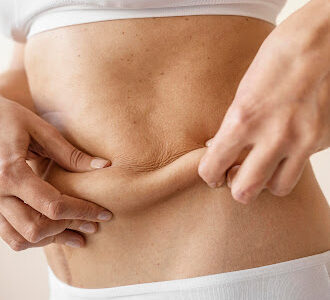 Skin Removal Hawthorn – Safe & Professional Skin Tag & Lesion Removal